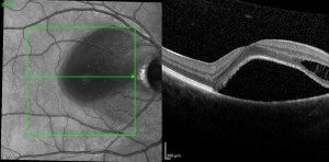 Fundus002