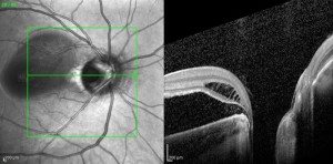 Fundus003