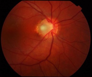 Fundus004